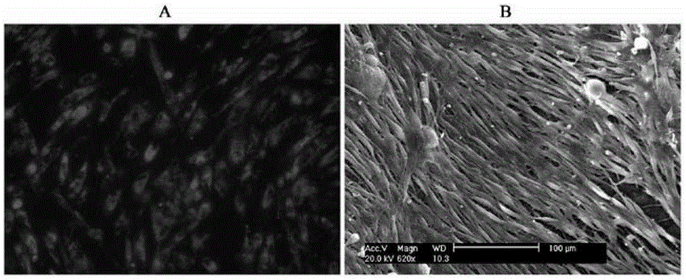 Organotype artificial skin, preparation method and application thereof