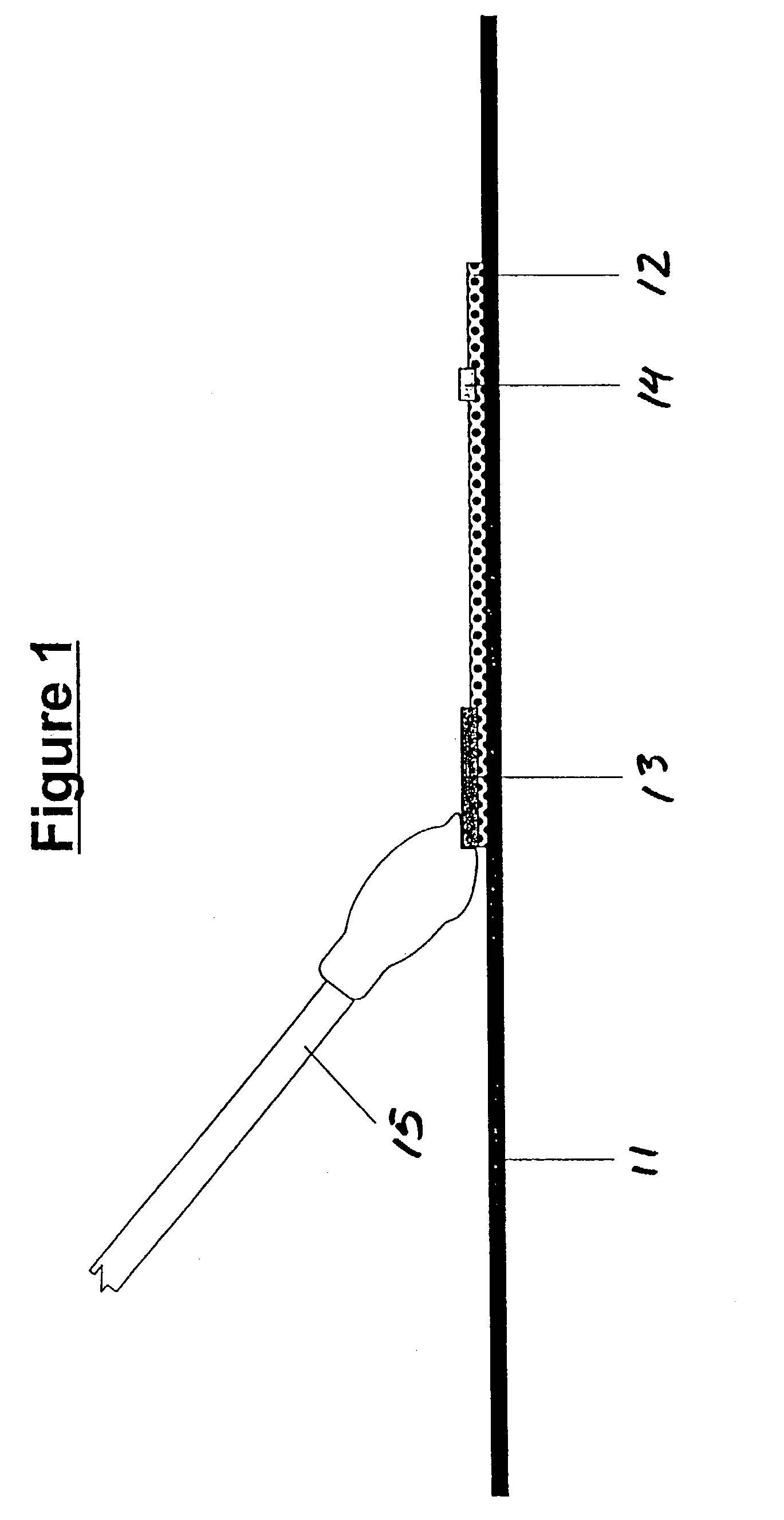 Assays for trichomonal and other hydrolases