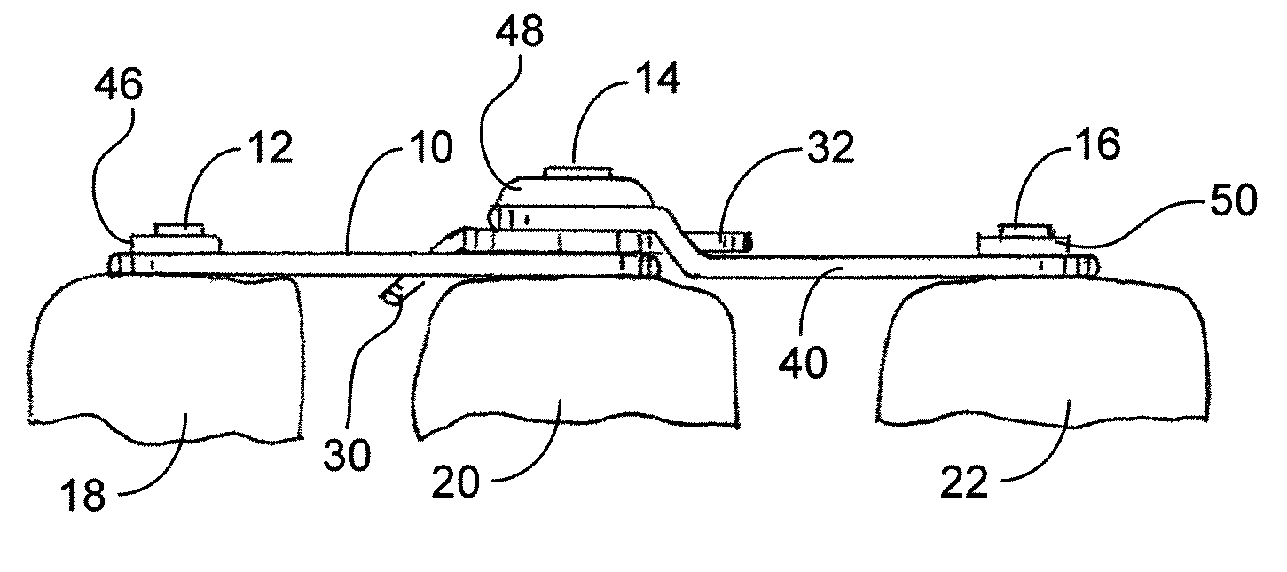 Adjustable spinal system