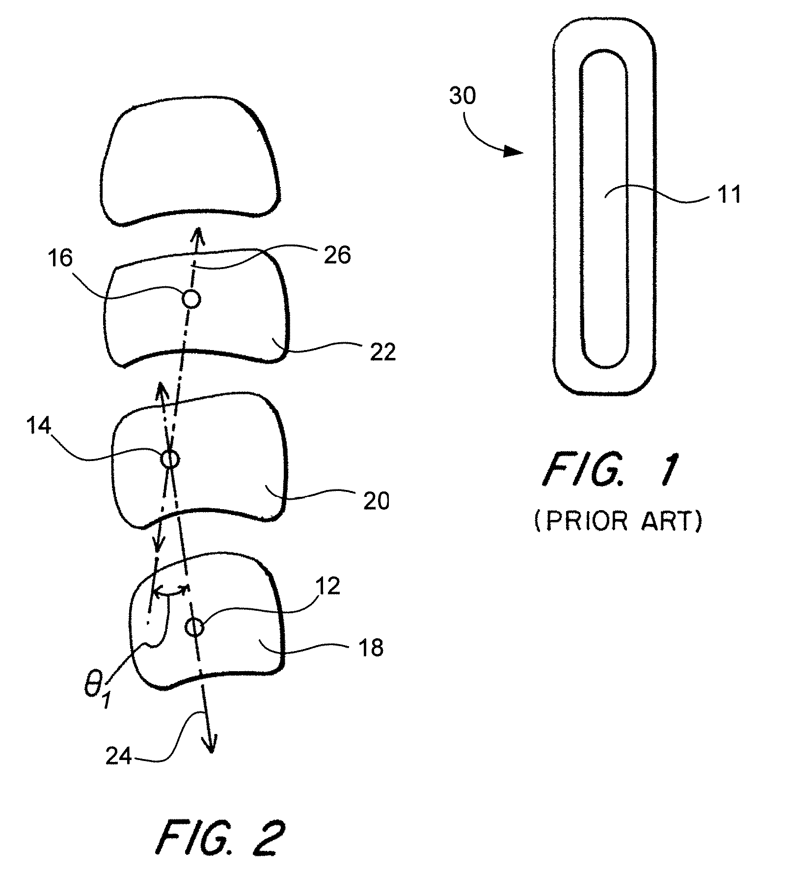 Adjustable spinal system