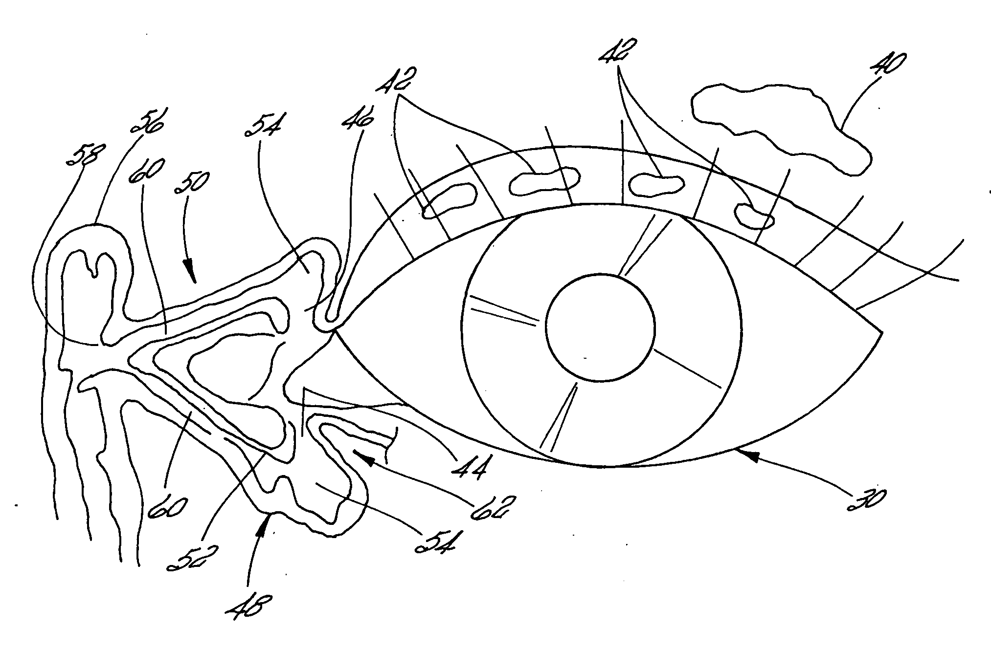 Implant capable of forming a differential image in an eye and methods of inserting and locating same