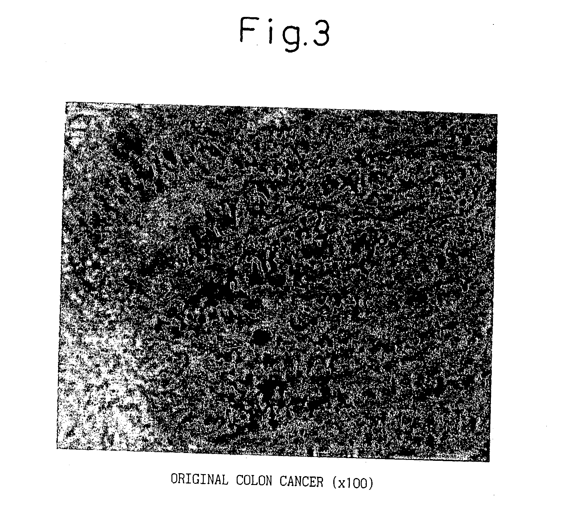 Coating material for living organism tissue, coated product from living organism tissue and method of coating living organism material