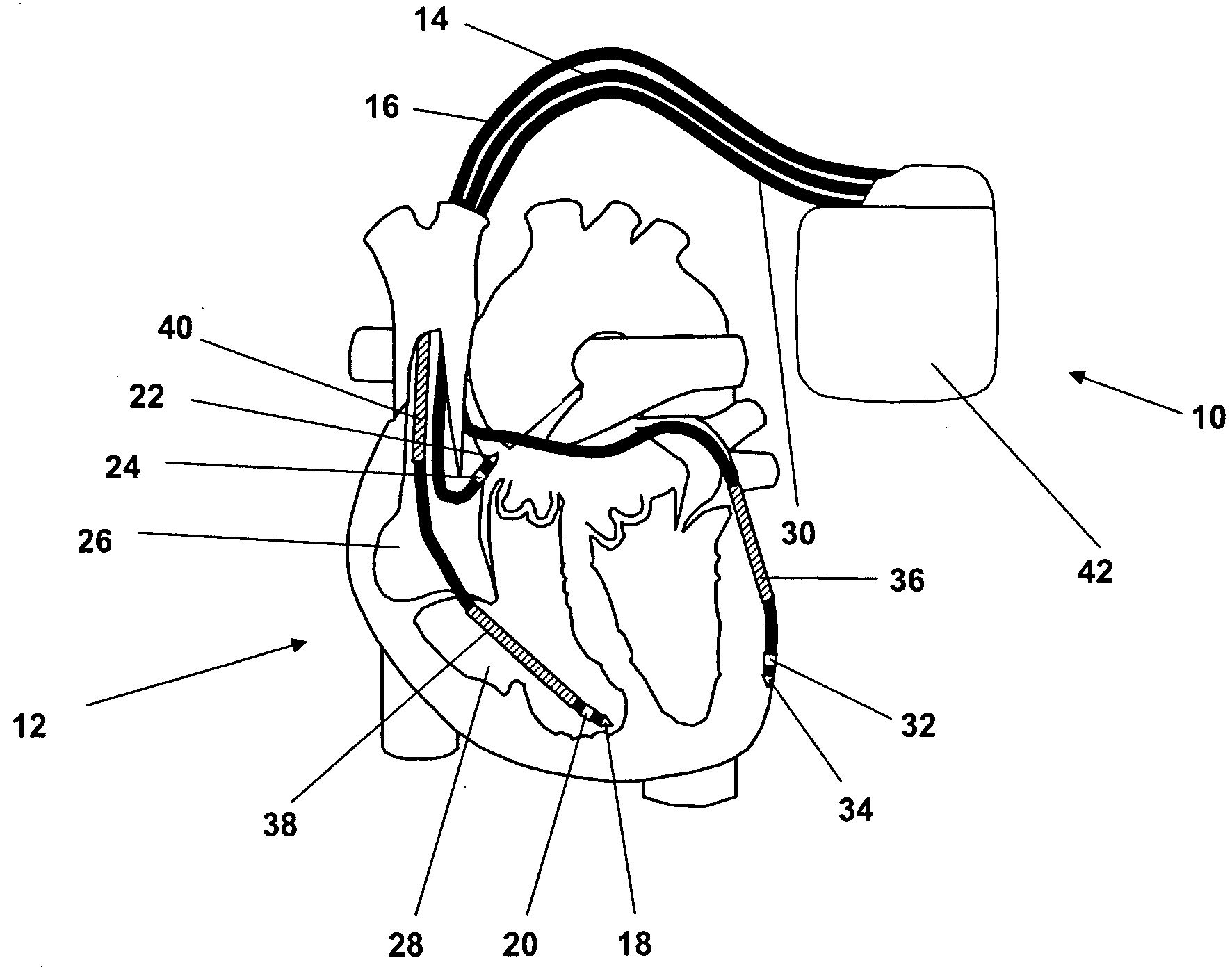 System and method for analyzing an impedance course