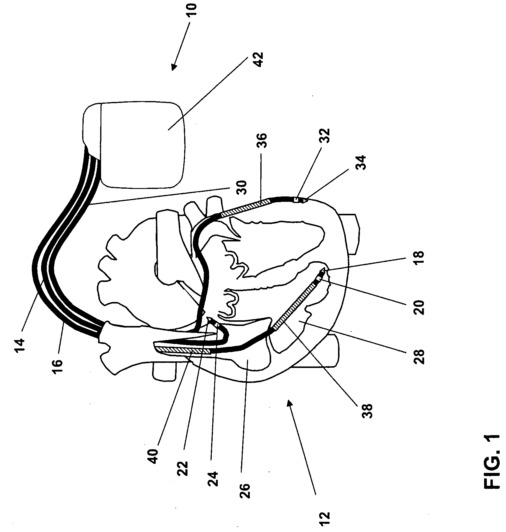 System and method for analyzing an impedance course