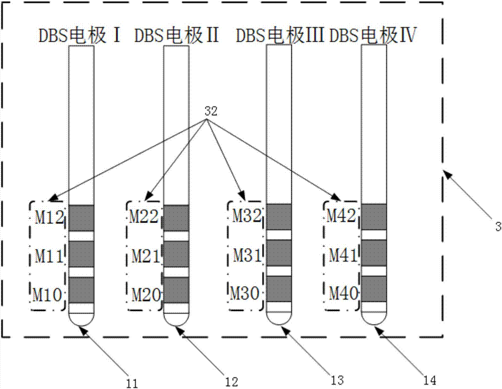 DSP+FPGA based local field potential real time detection analysis platform eliminating DBS artifacts