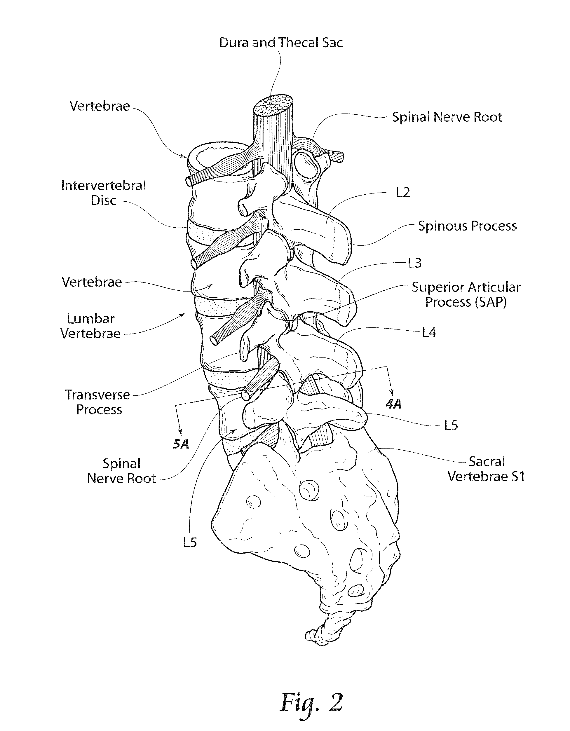 Methods, Systems, and Devices for the Treatment of Stenosis