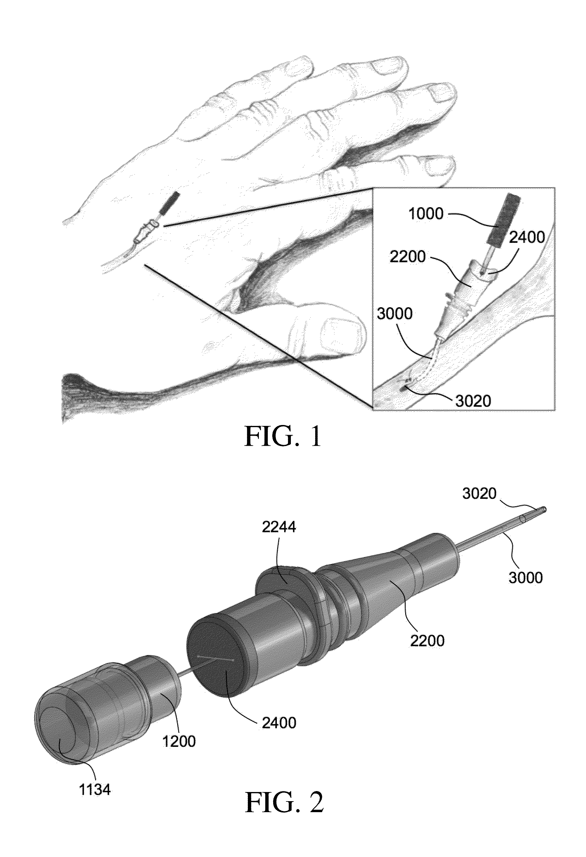 Vascular blood sampling catheter