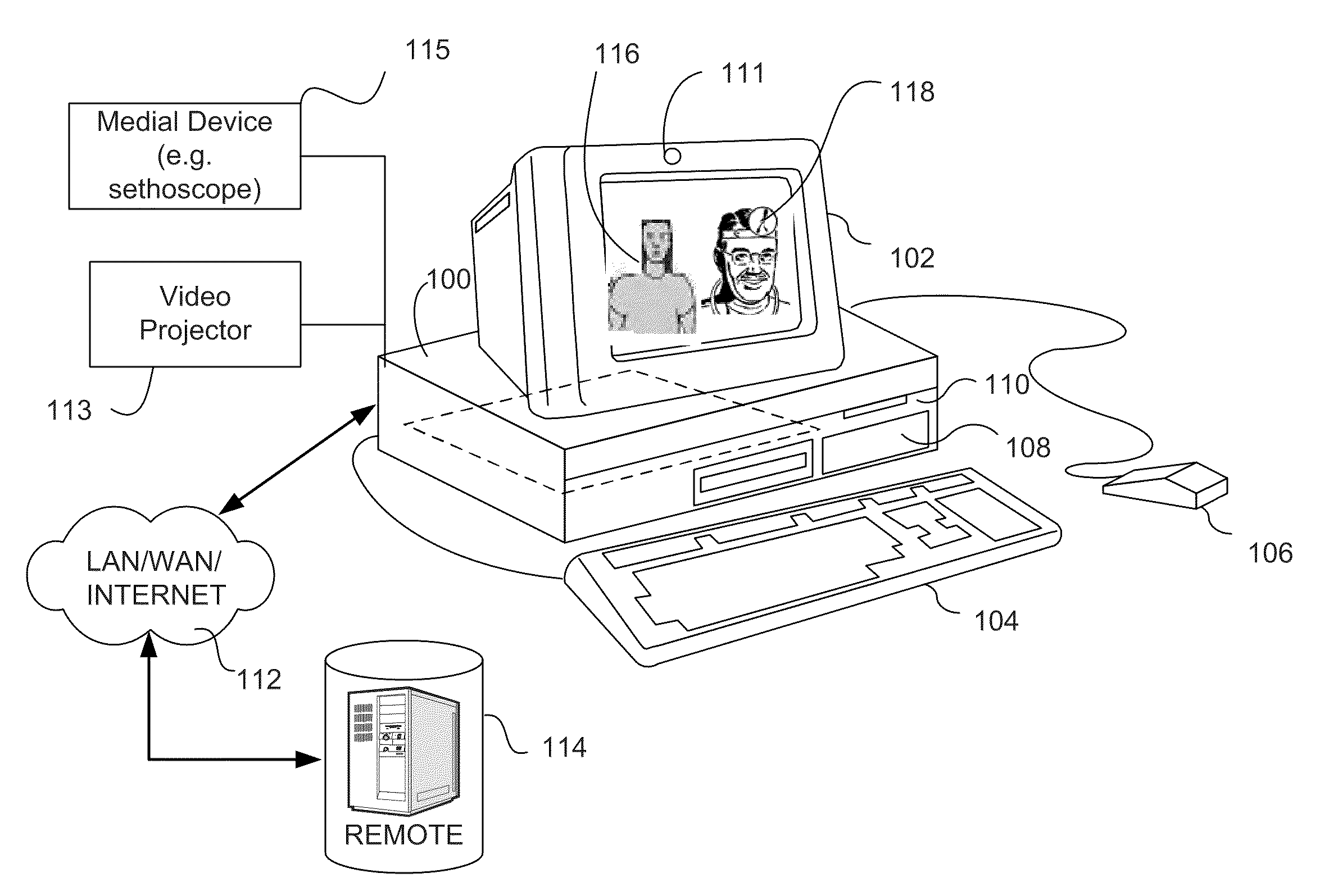 Automatic body silhouette matching for remote auscultation