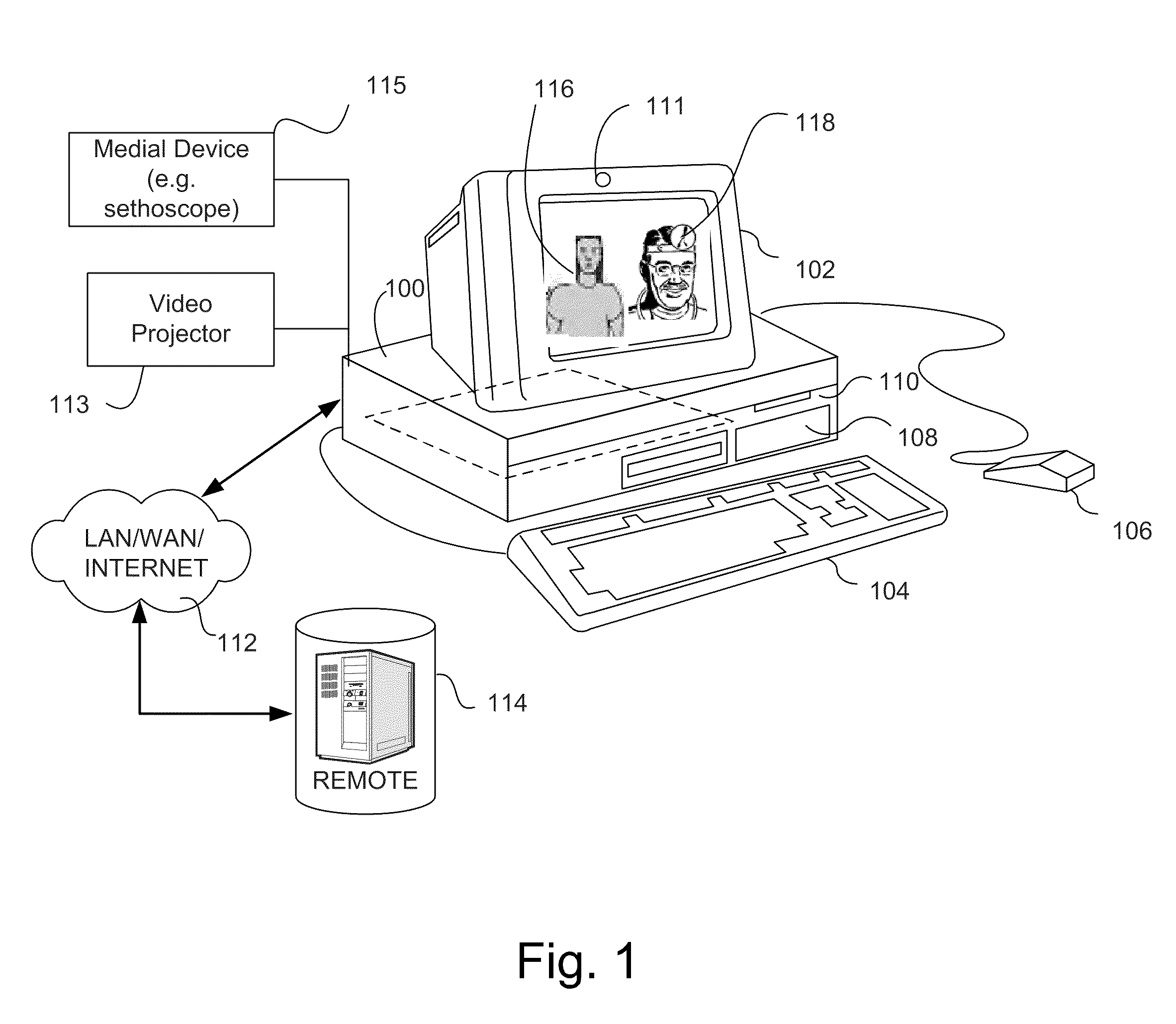 Automatic body silhouette matching for remote auscultation