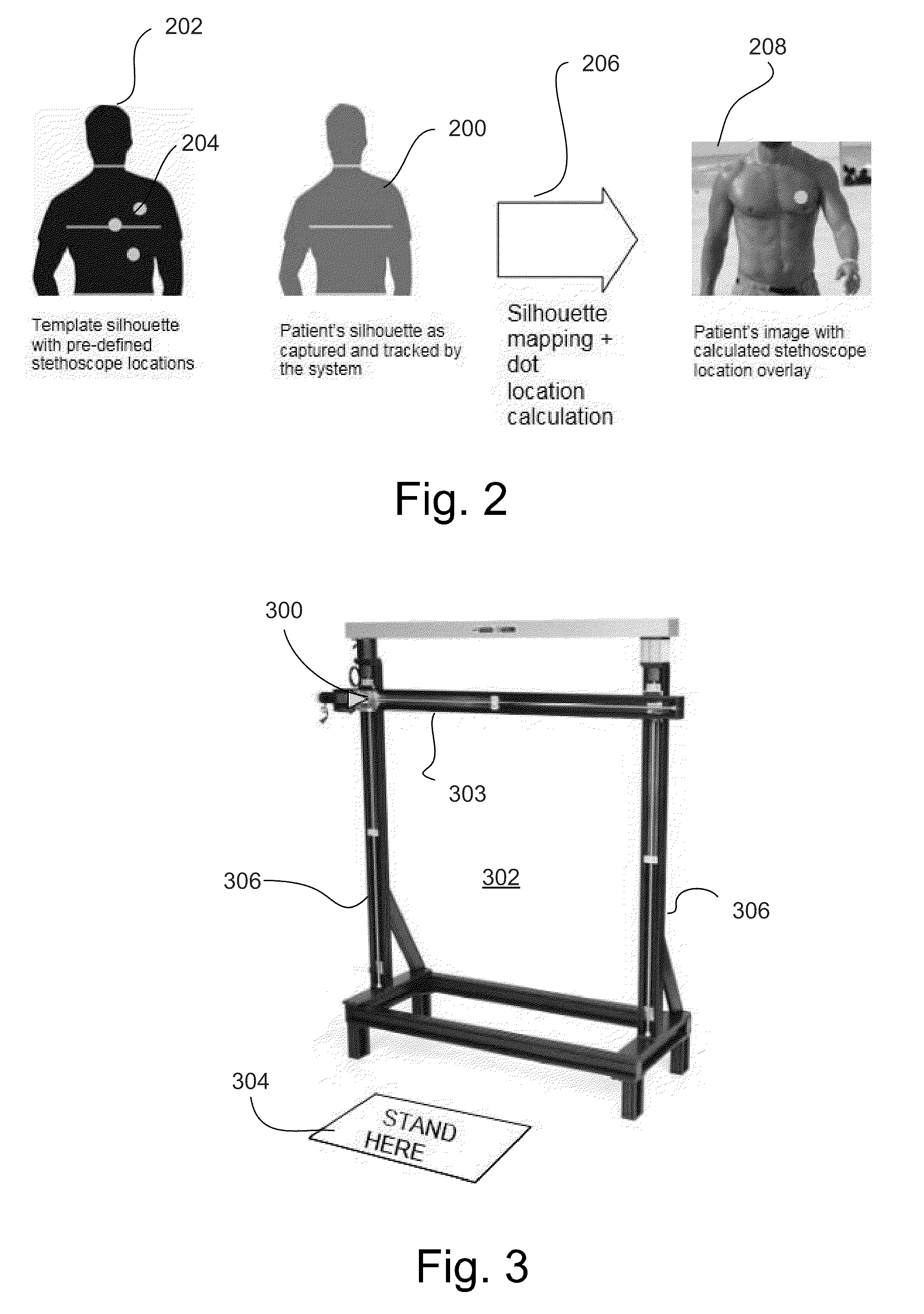 Automatic body silhouette matching for remote auscultation