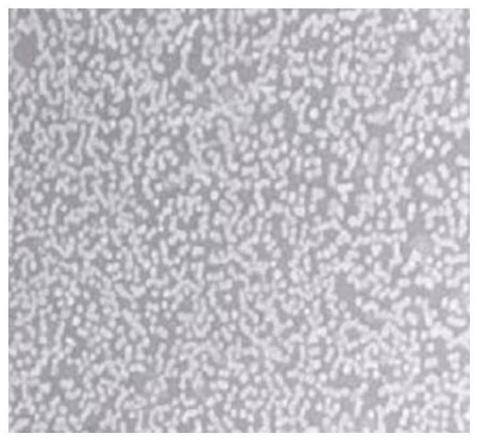 DNA fluorescence in situ hybridization BCR/ABL fusion state detection method and detection system