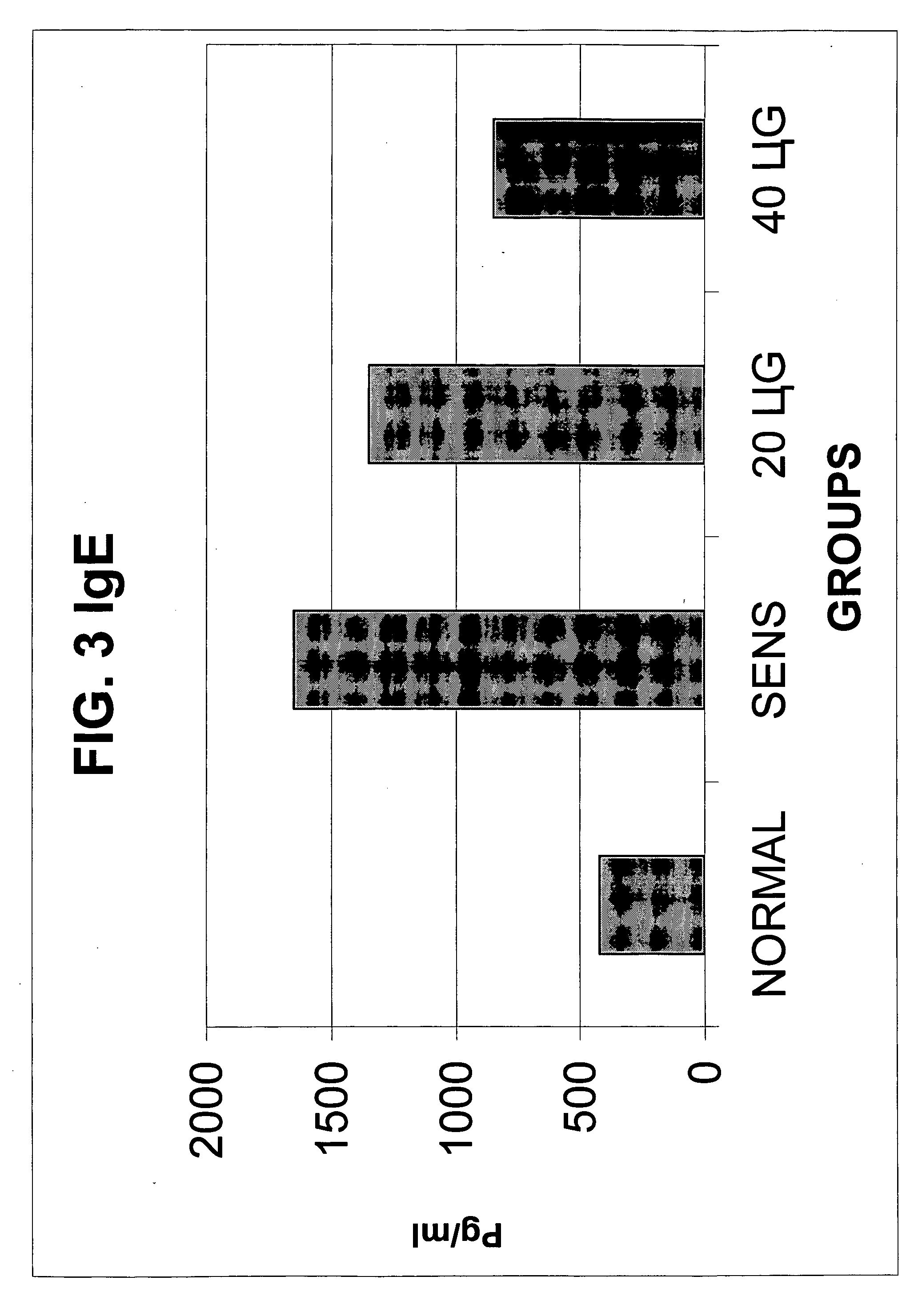 Sterically stabilized liposome and triamcinolone composition for treating the respiratory tract of a mammal