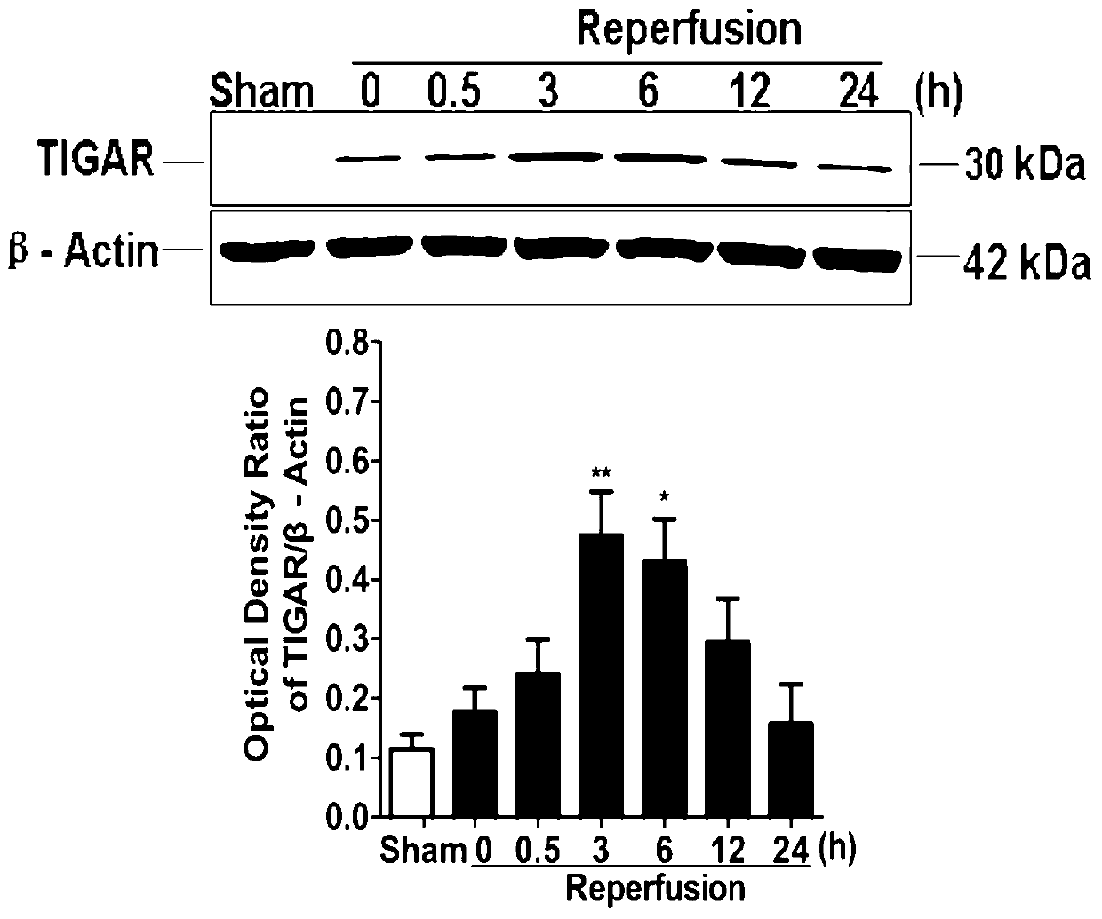 Application of NADPH in preparing medicaments for preventing and treating ischemic cerebral stroke