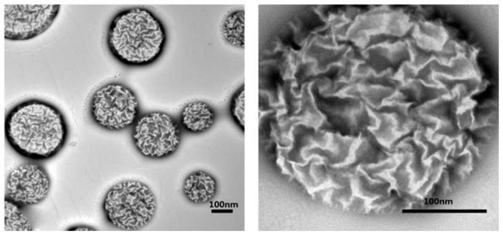 A nano drug delivery system loaded with 5-aminolevulinic acid and its preparation method and application