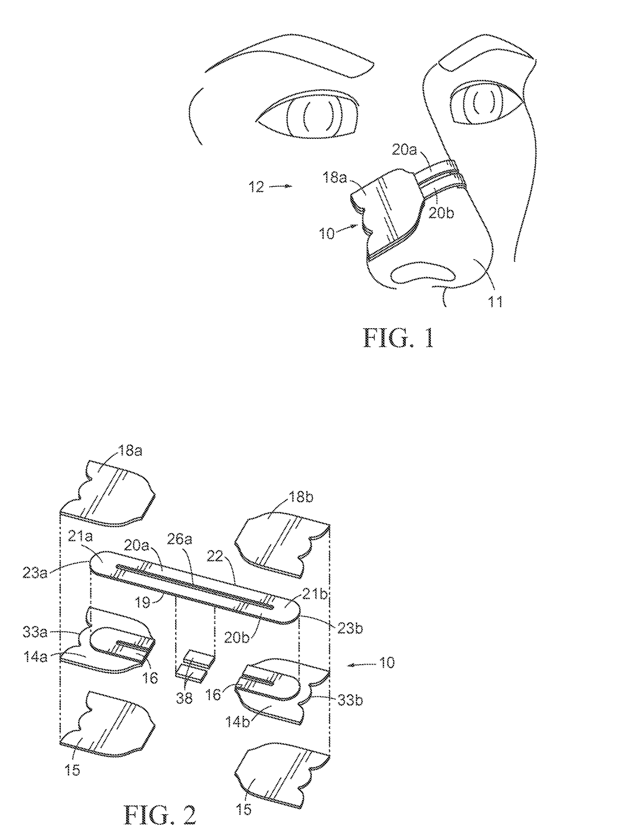 Economical Nasal Dilator and Method of Manufacture