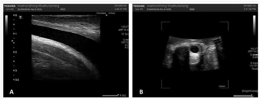 A method for constructing a segmental individualized human urethral tissue solid model