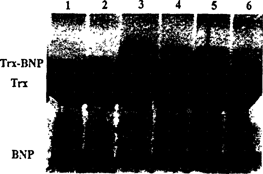 Enterpeptidase light chain variant with high activity and high stability