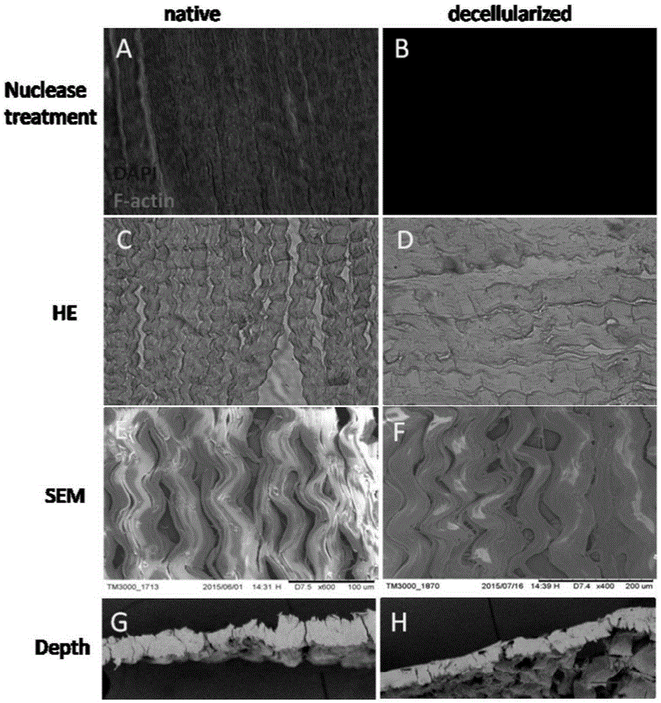 Method for preparing cardiac muscle tissue engineering decellularization collagen diaphragm