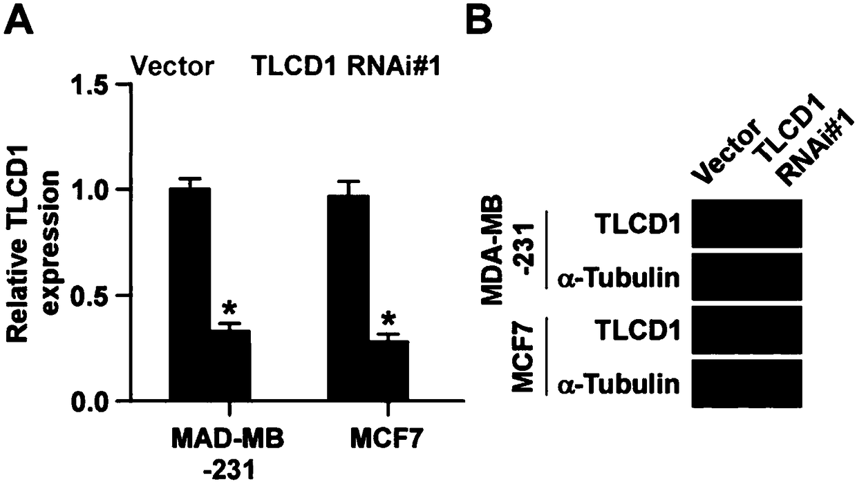 Application of TLCD1 to diagnosis, prognosis and treatment of BC (breast cancer) metastasis