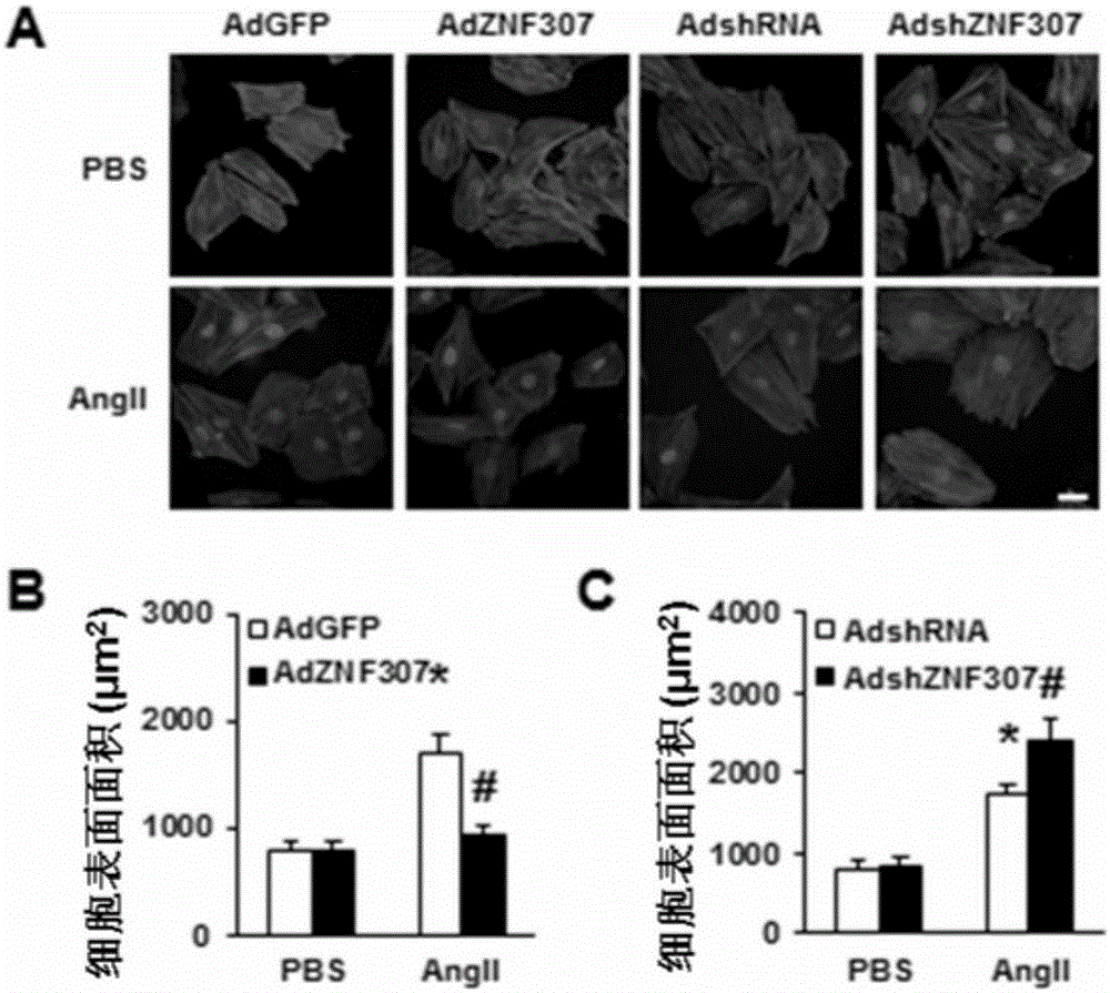 Application of zinc finger protein 307 (ZNF307) in treating myocardial hypertrophy