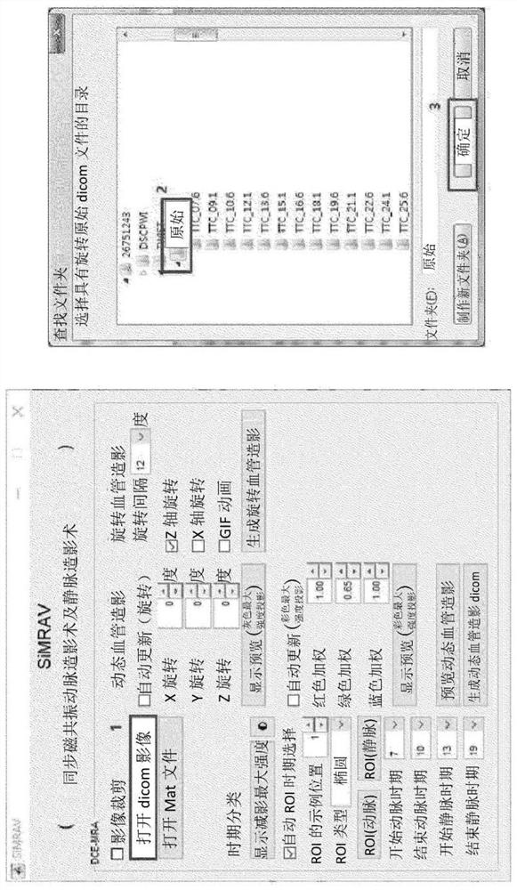 Method for simultaneously realizing three-dimensional subtraction arteriography, three-dimensional subtraction vein angiography and four-dimensional color angiography through image information post-processing of four-dimensional magnetic resonance angiography and medical imaging system