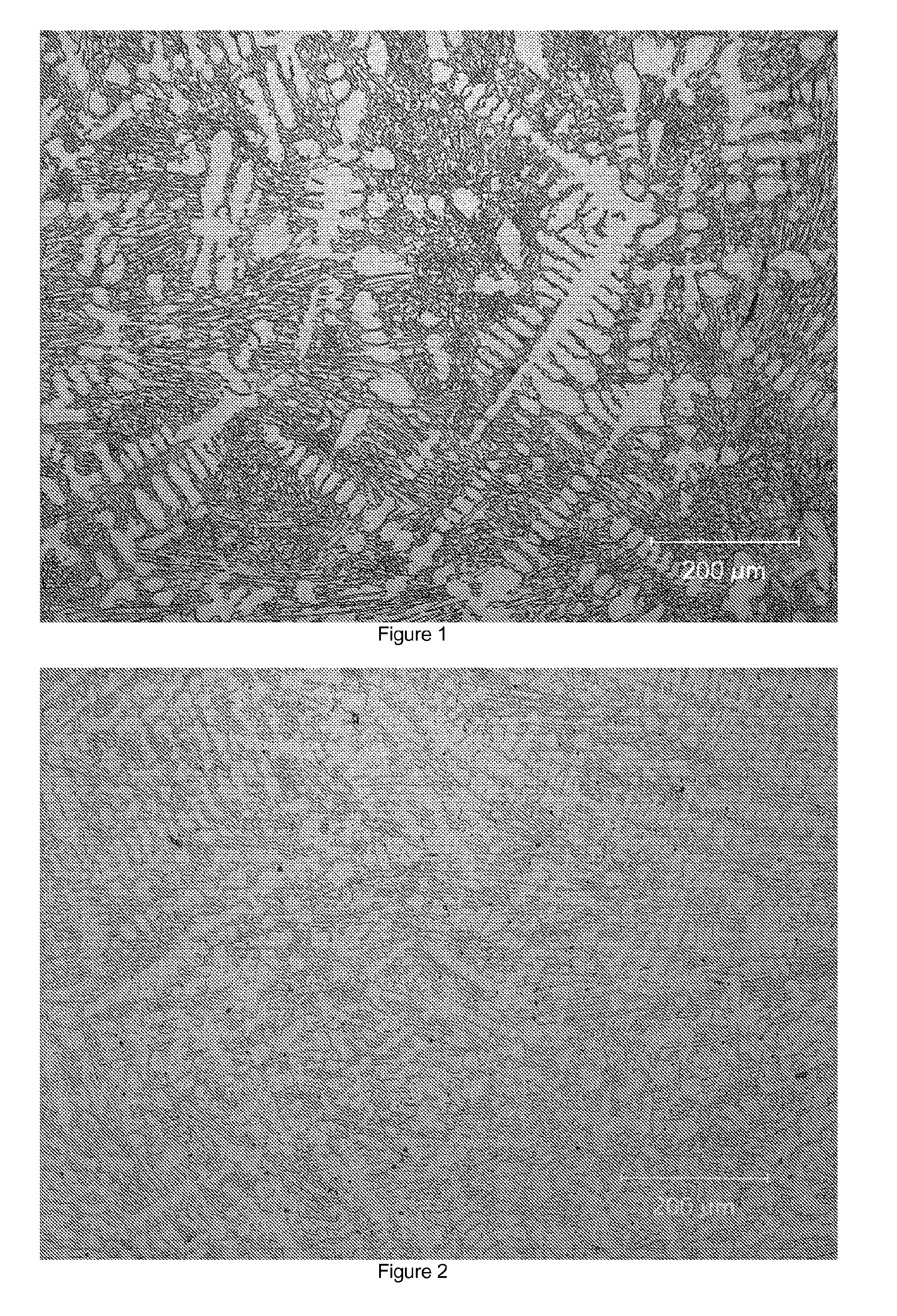 Metal alloys for high impact applications