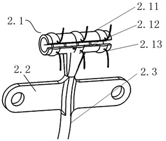 Minimally invasive electrical stimulation system