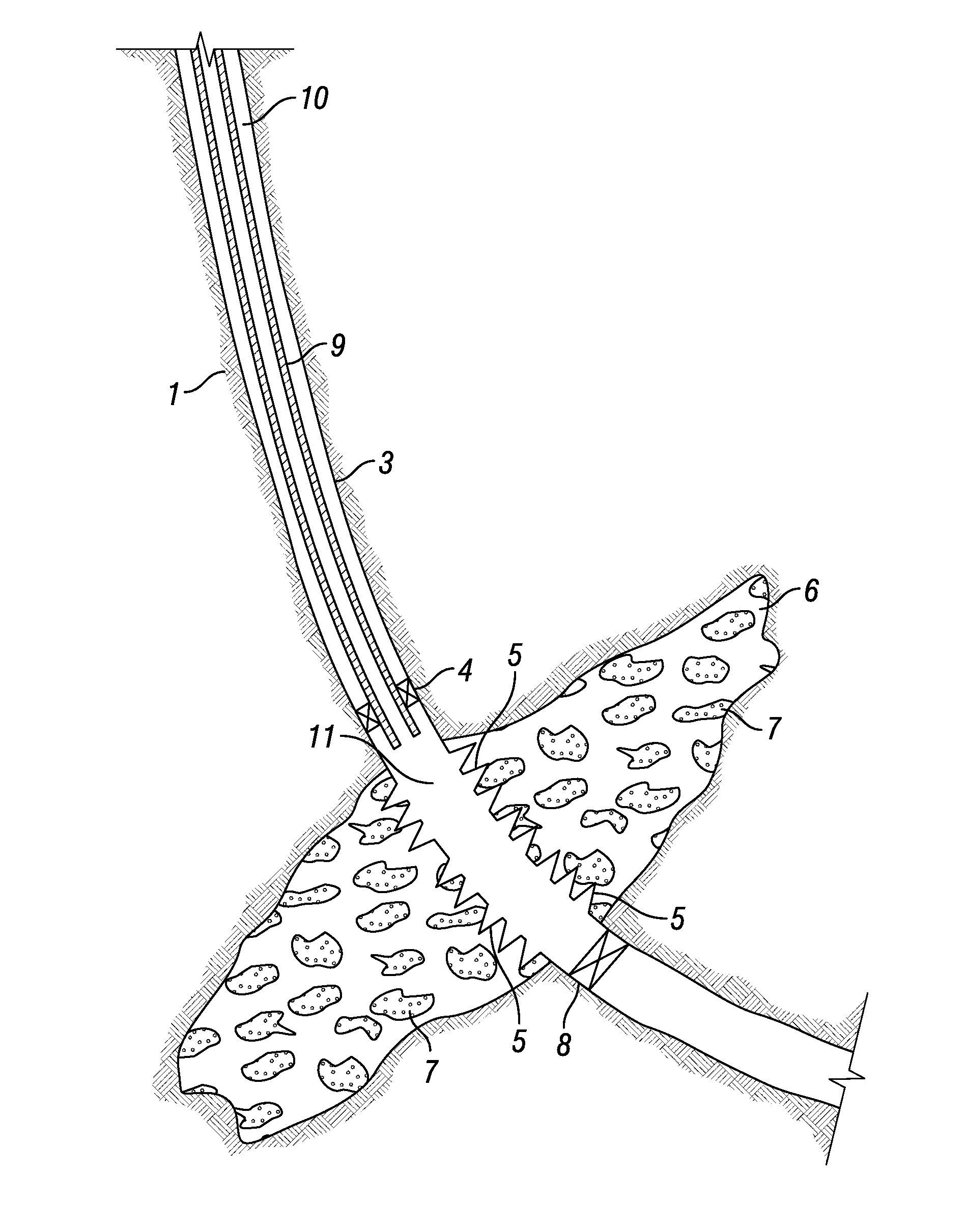 Methods of Enhancing the Fracture Conductivity of Multiple Interval Fractures in Subterranean Formations Propped with Cement Packs