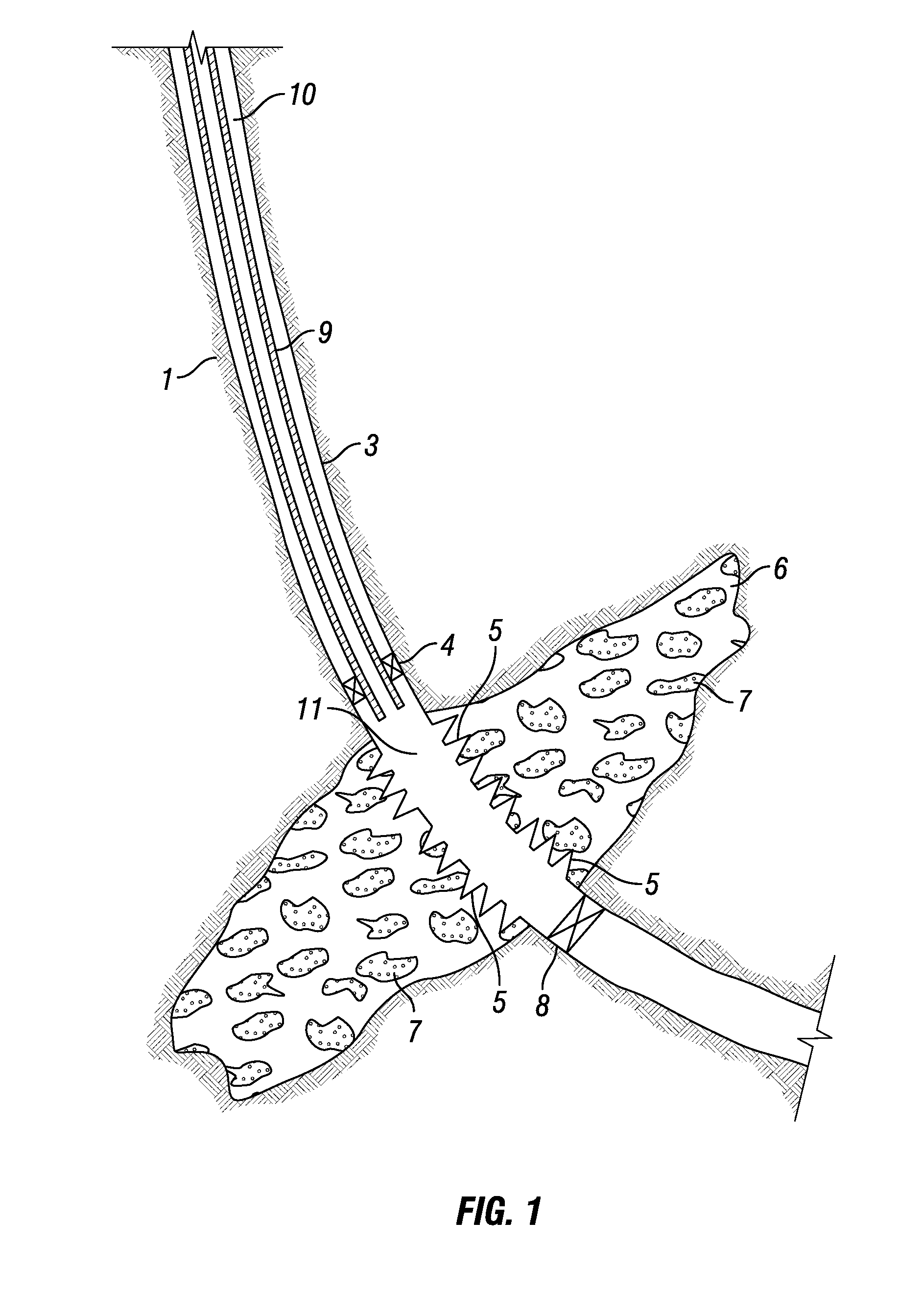 Methods of Enhancing the Fracture Conductivity of Multiple Interval Fractures in Subterranean Formations Propped with Cement Packs