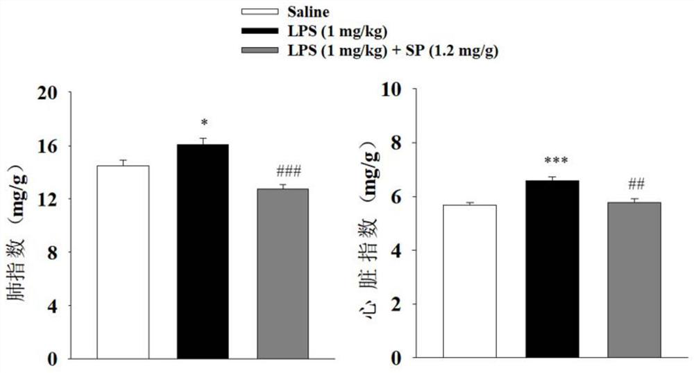 Application of sodium propionate in preparation of medicine for treating bronchopulmonary dysplasia