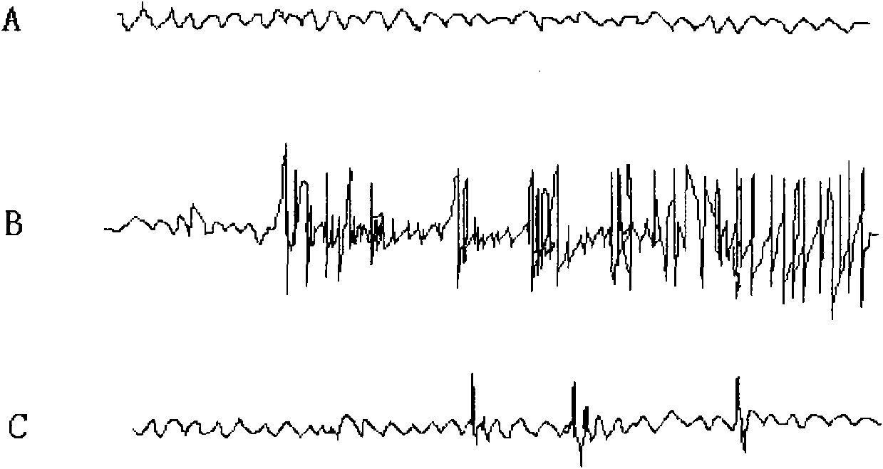 Application of 2-phenylphenol and derivatives thereof to medicine for treating epilepsia