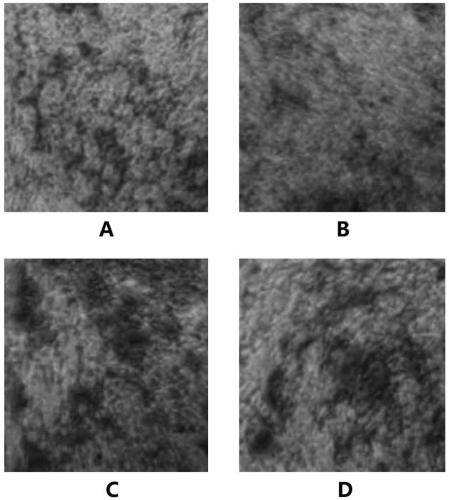 Method for promoting multiplication of adipose-derived stem cells