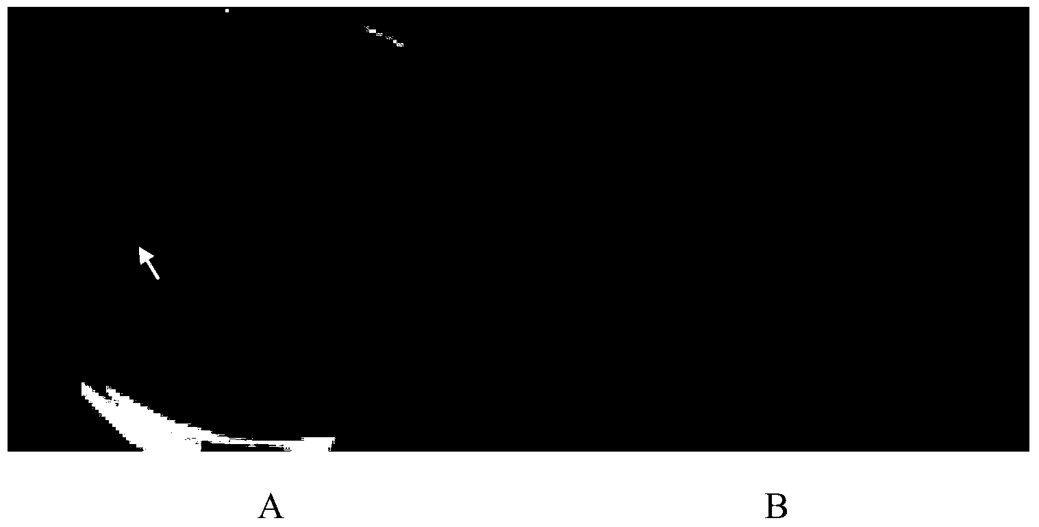 Enterococcus faecalis phage lyase and coding gene and application thereof