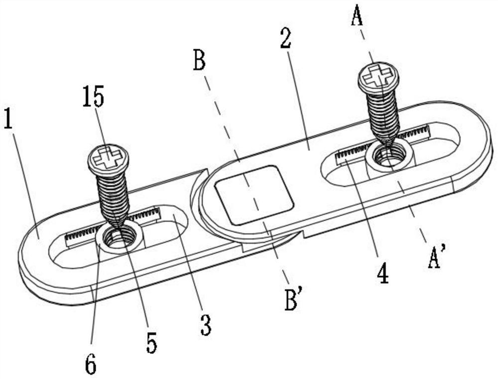 Thoracic surgery rib fracture fixing device