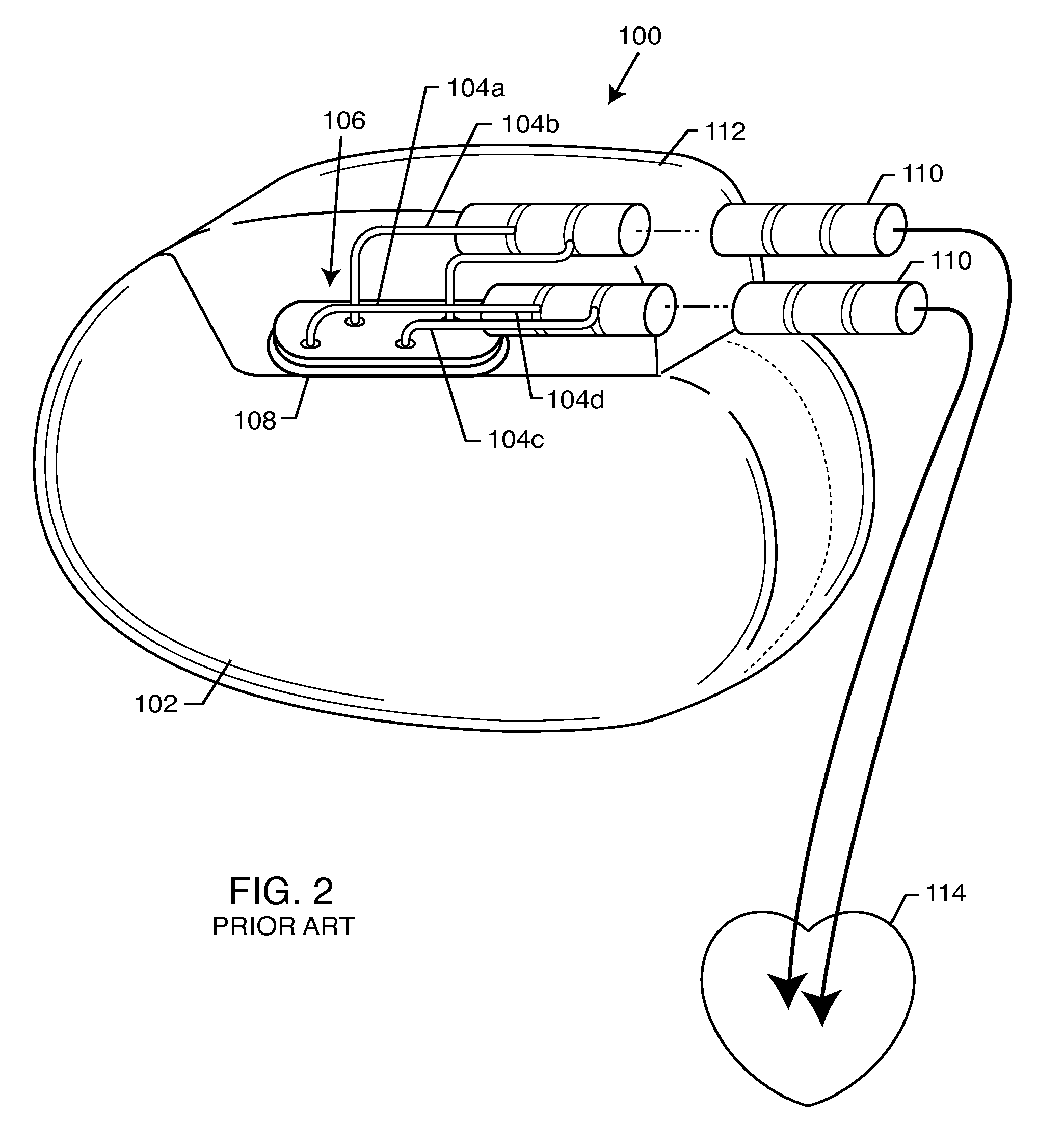 RFID-enabled AIMD programmer system for identifying MRI compatibility of implanted leads