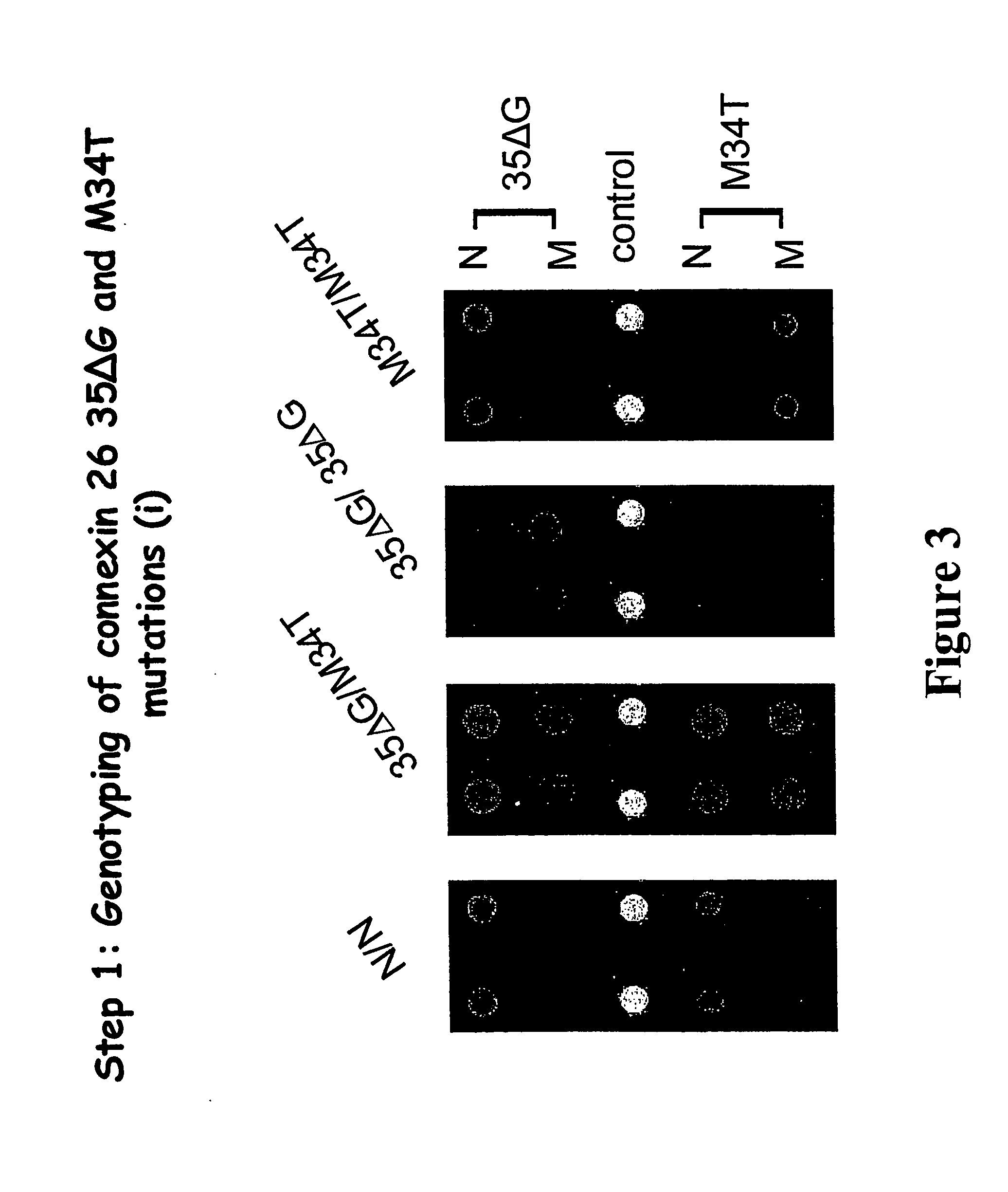 Genotyping of deafness by oligonucleotide microarray analysis