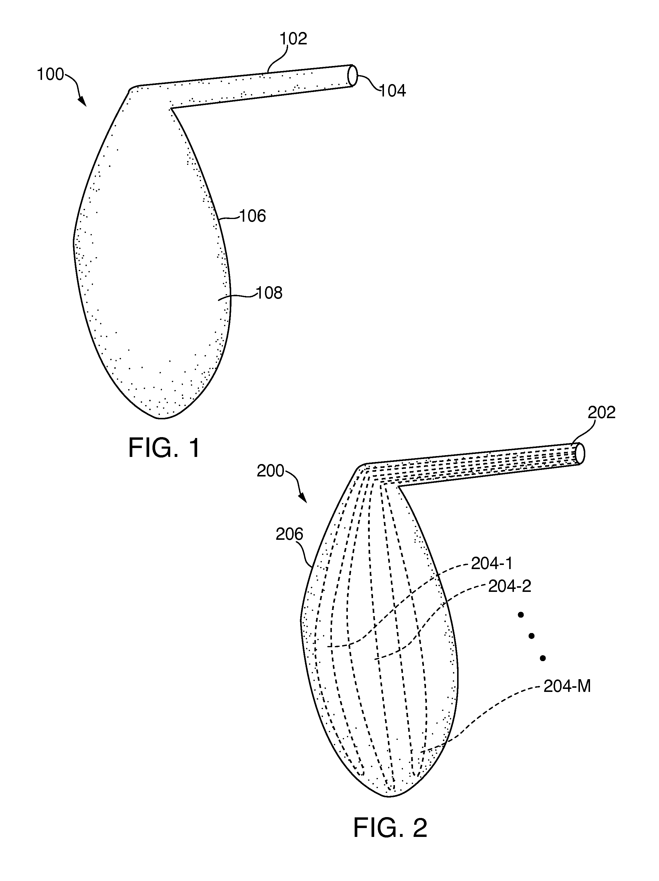 Small Incision, Customizable Specific Gravity Prosthesis