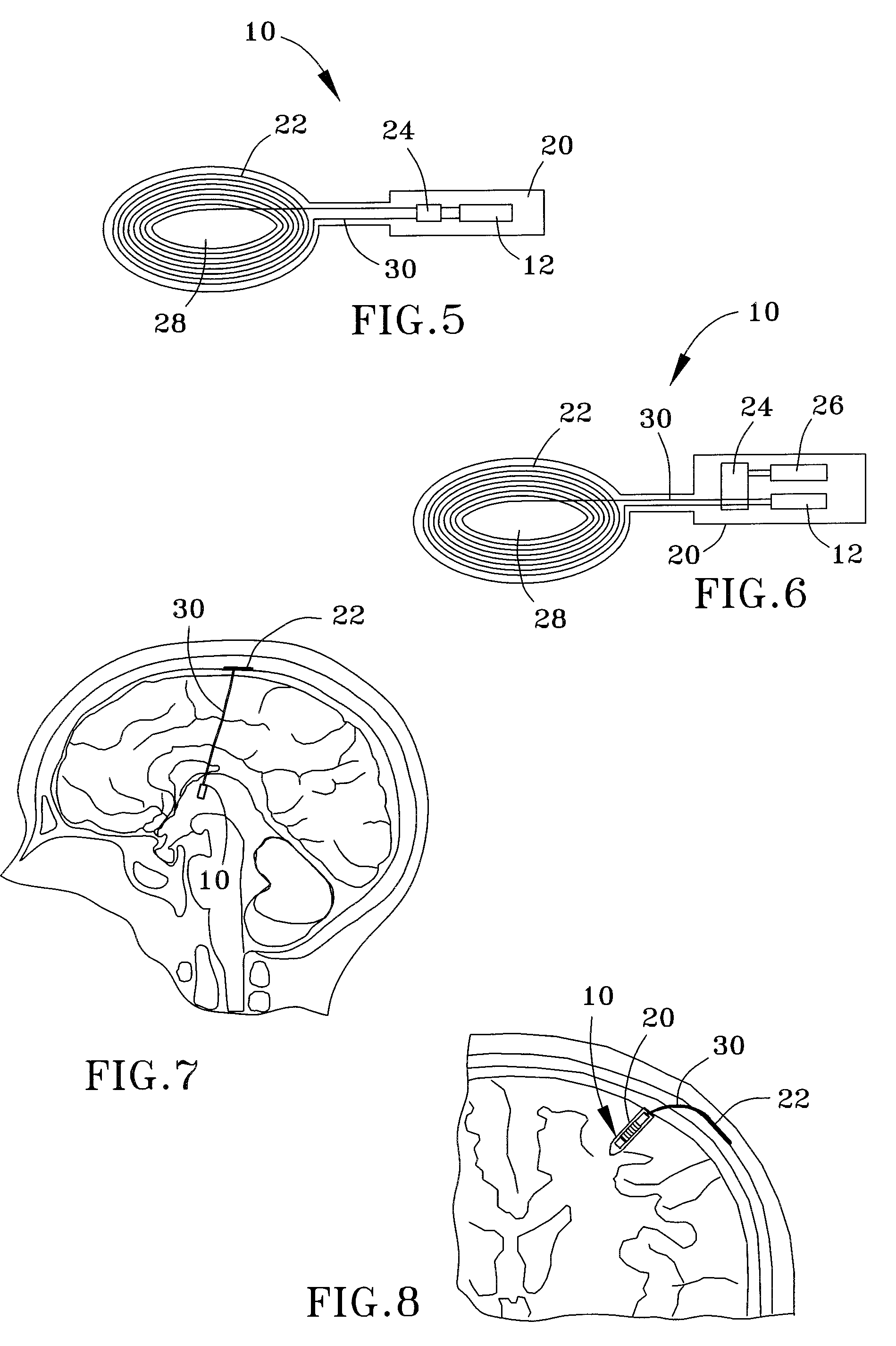 Miniature wireless system for deep brain stimulation