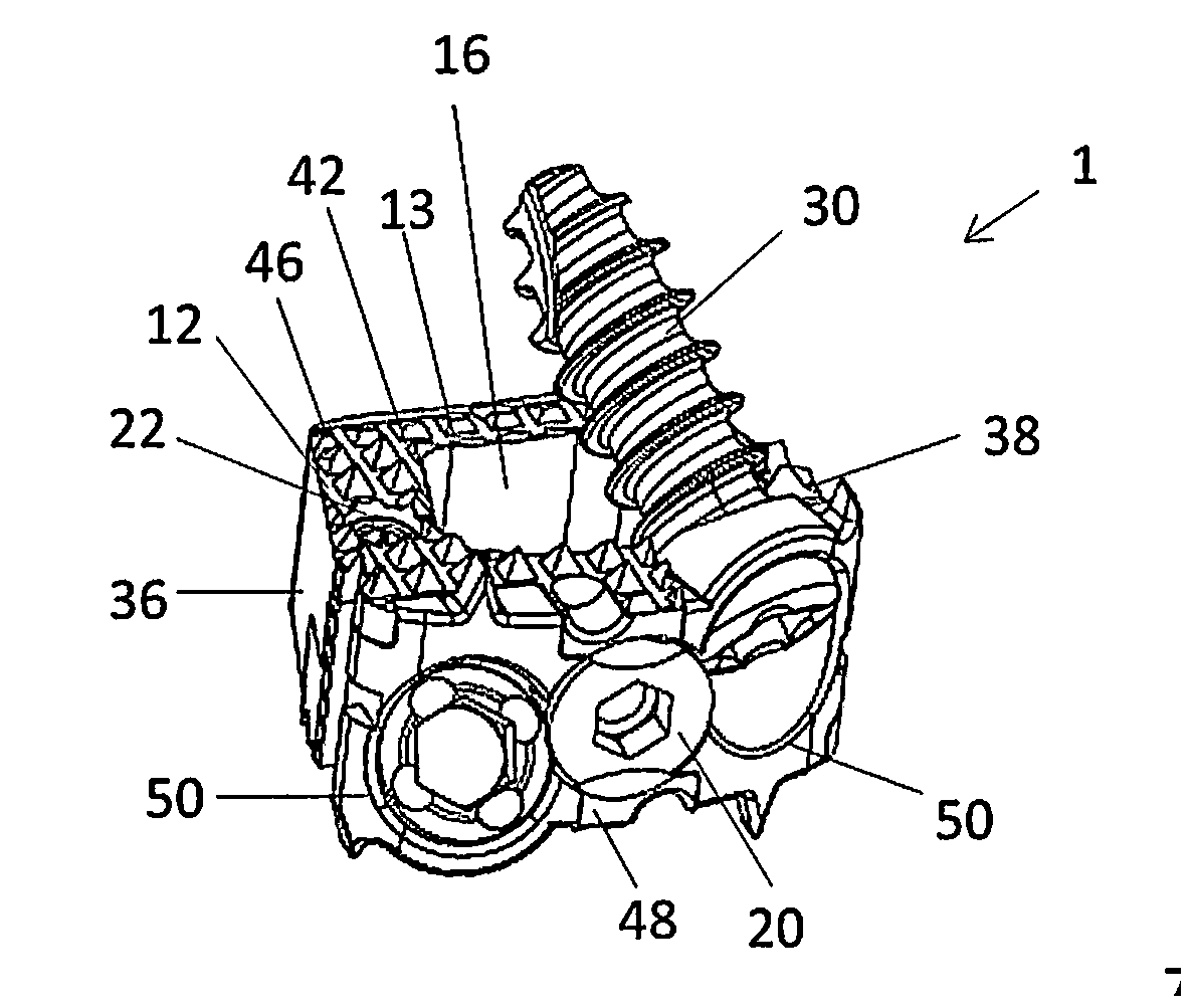 Standalone Interbody Implants