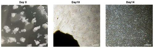 Temperature-sensitive hydrogel compound suitable for carrying human umbilical cord Wharton's Jelly-derived mesenchymal stem cells and application of temperature-sensitive hydrogel compound