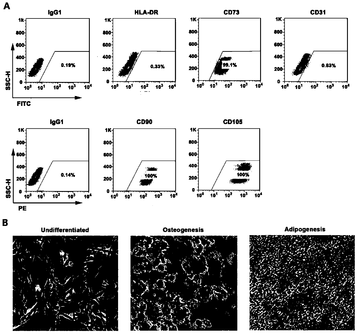 Temperature-sensitive hydrogel compound suitable for carrying human umbilical cord Wharton's Jelly-derived mesenchymal stem cells and application of temperature-sensitive hydrogel compound