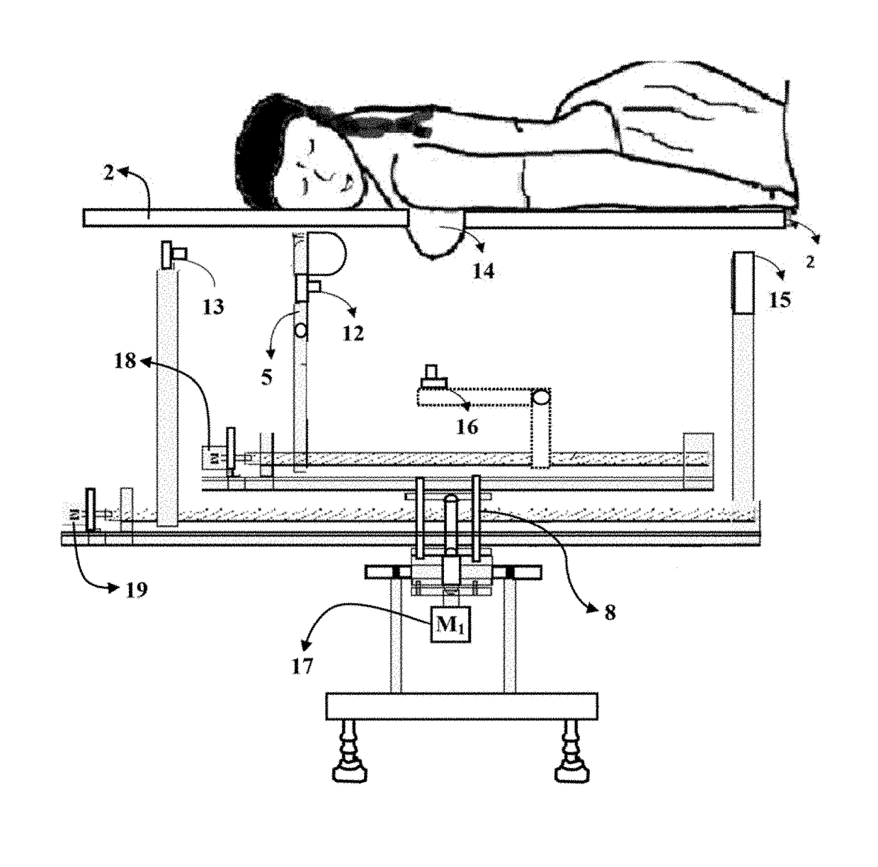 Device with simultaneous X-ray and infrared image acquisition and processing system for enhanced breast imaging