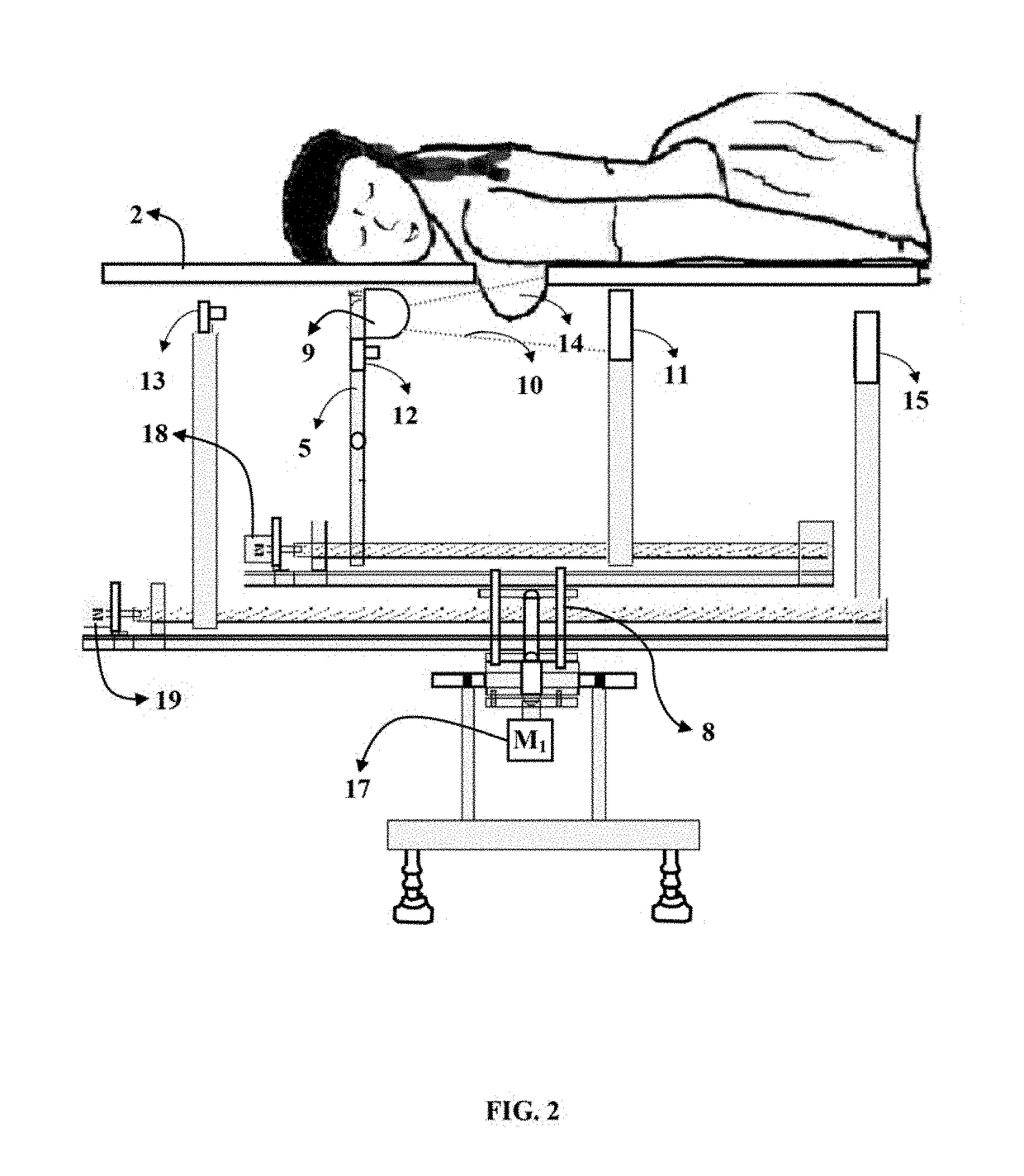 Device with simultaneous X-ray and infrared image acquisition and processing system for enhanced breast imaging