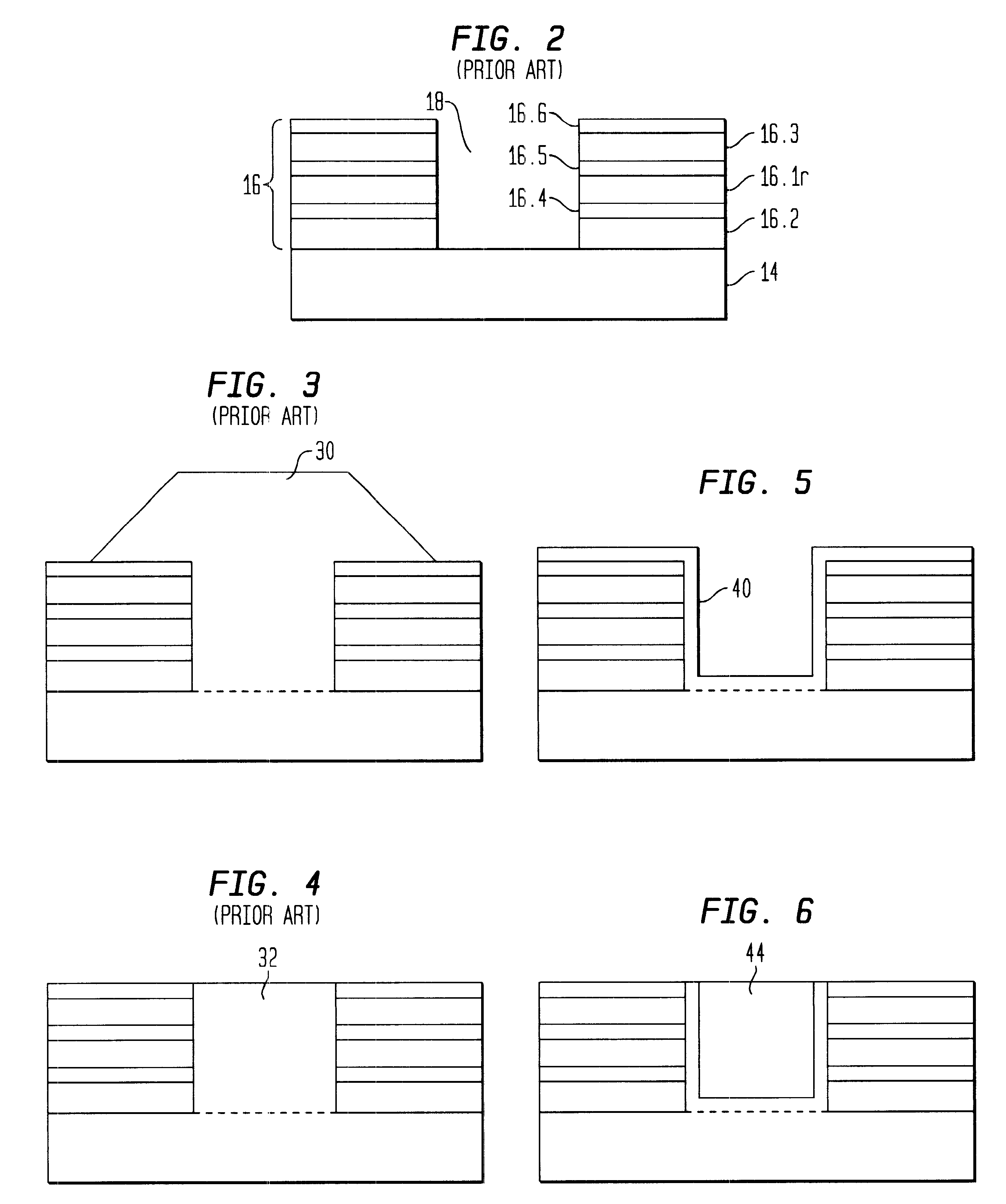 Ultra thin body vertical replacement gate MOSFET