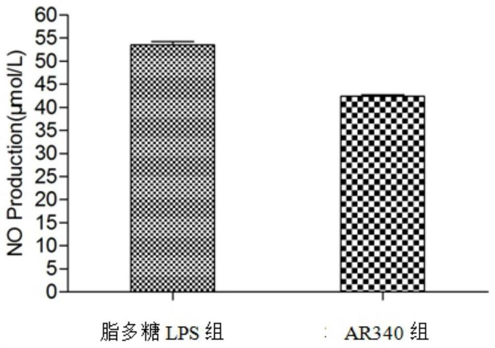 Lactobacillus paracasei capable of antagonizing pharyngitis pathogenic bacterium beta hemolytic streptococcus