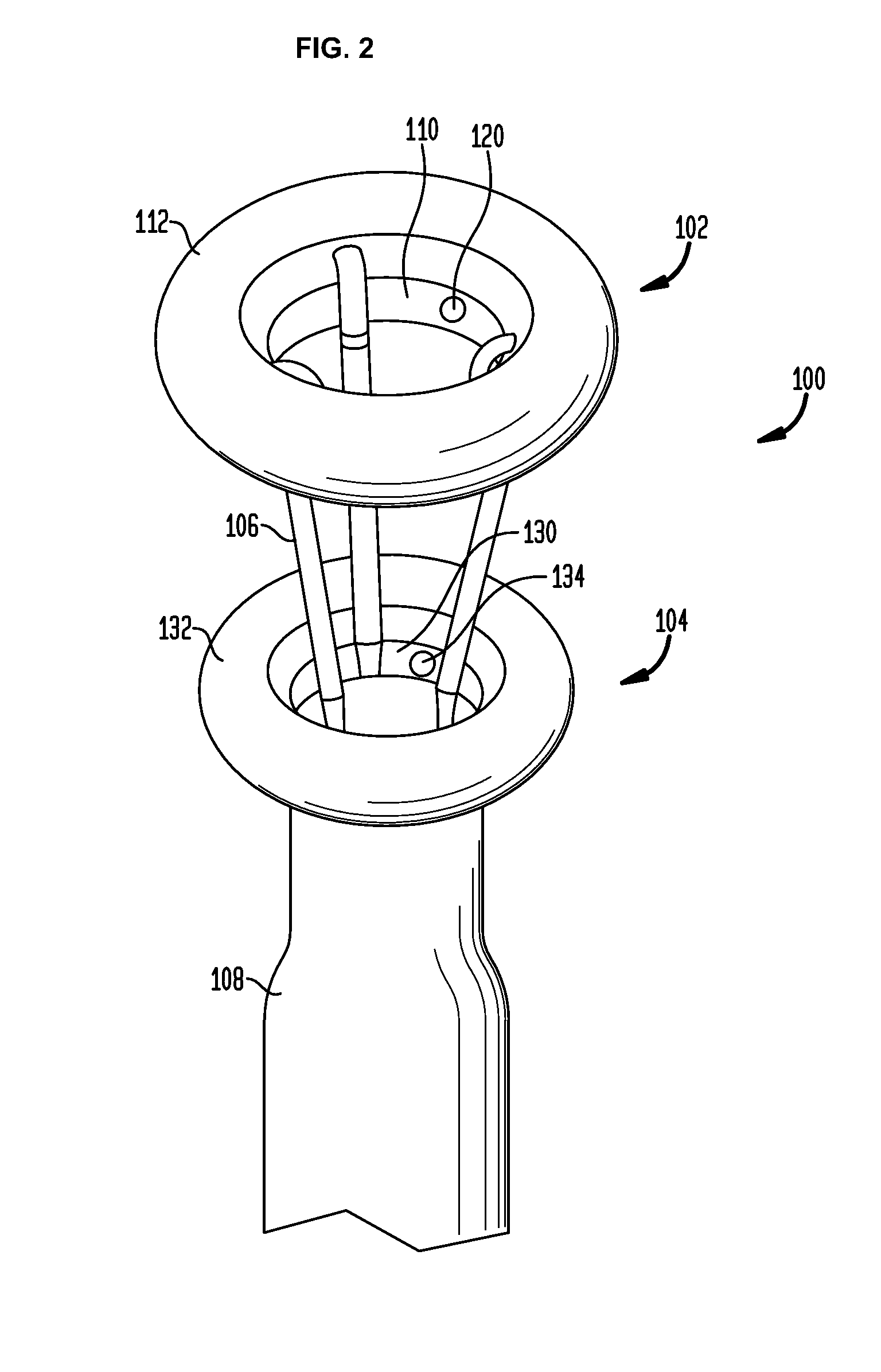 Systems and methods for treatment of obesity and type 2 diabetes