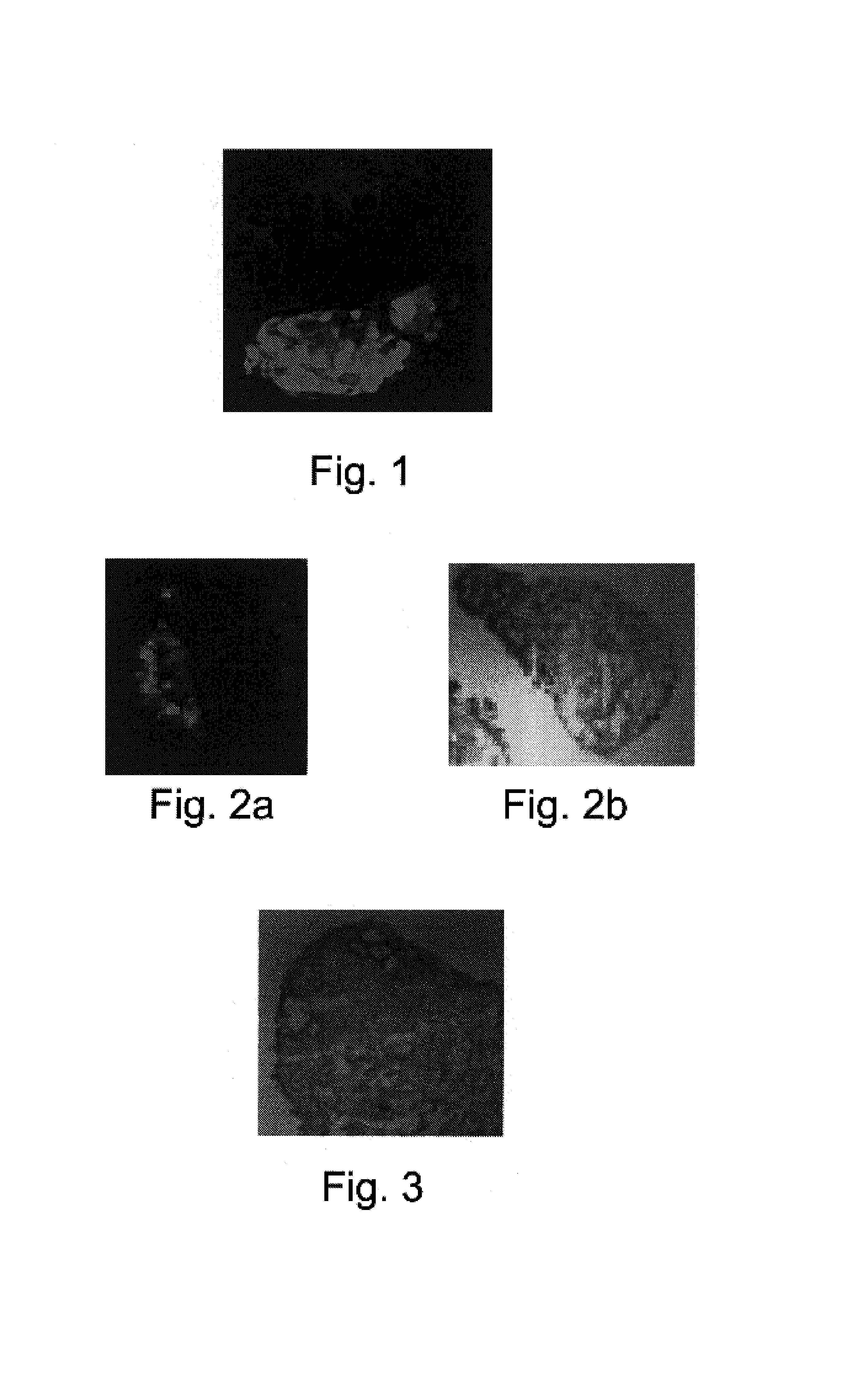 Methods of generating tissue using devitalized, acellular scaffold matrices derived from micro-organs