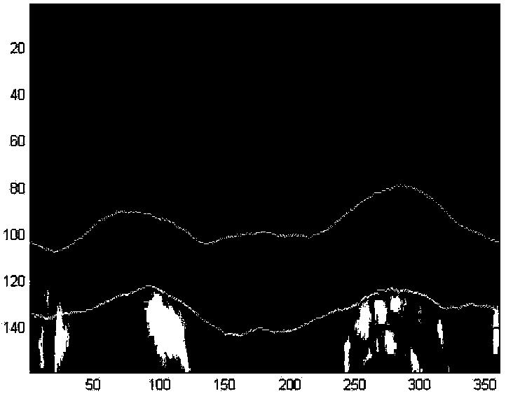 Ultrasonic carotid plaque automatic segmentation method