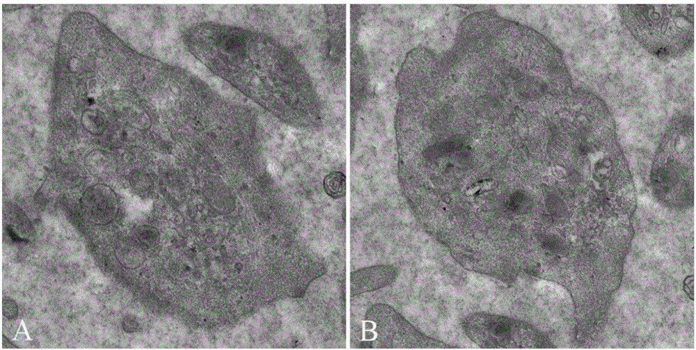 Platelet-enriched plasma, as well as preparation method and application thereof