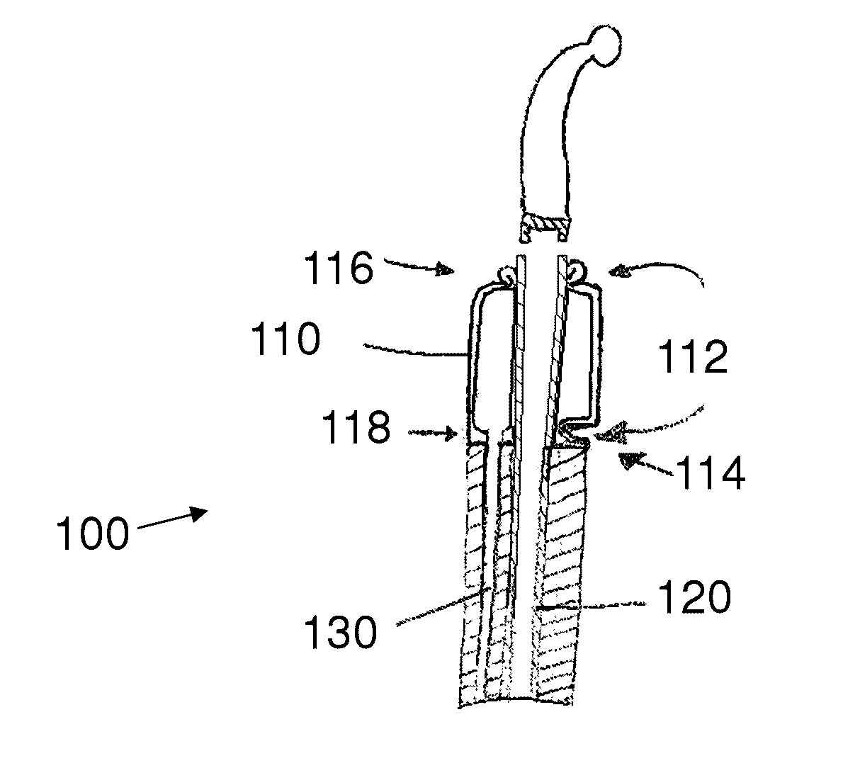 Stretch valve balloon catheter and methods for producing and using same